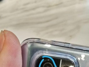 解决电视机白点问题的有效方法（探索如何处理和修复电视机上的白点缺陷）