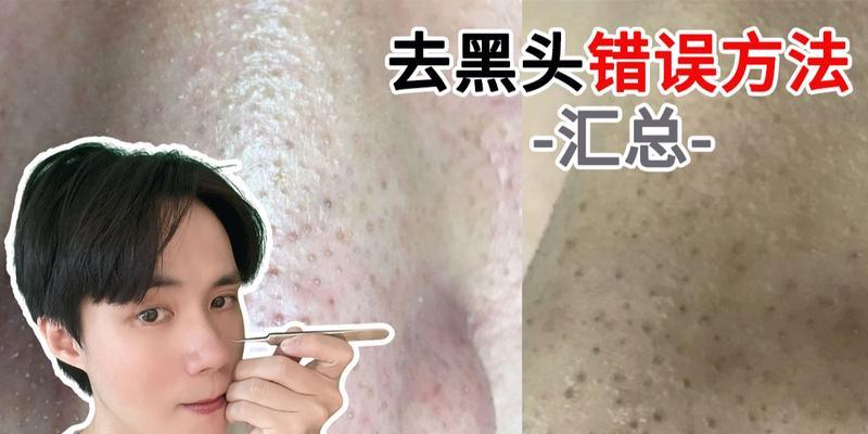 苹果笔记本怎么样去黑头？有效的方法有哪些？  第1张