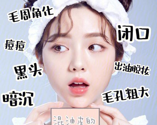 苹果笔记本怎么样去黑头？有效的方法有哪些？  第3张